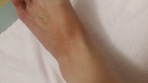 過酸化脂質の減少【くすみ・黒ずみの改善】